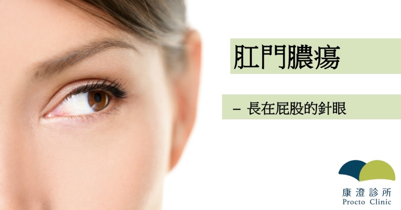 一隻眼睛的特寫,圖上有「肛門膿瘍:長在屁股的針眼」字樣