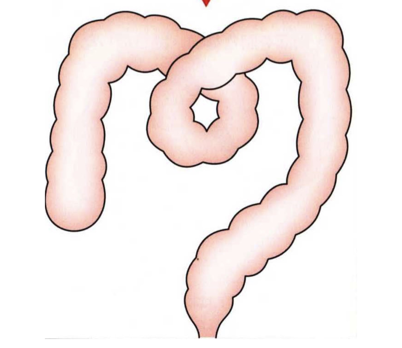 迂迴打結的大腸示意圖